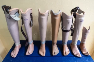 Rotary improving healthcare facilities with essential equipment